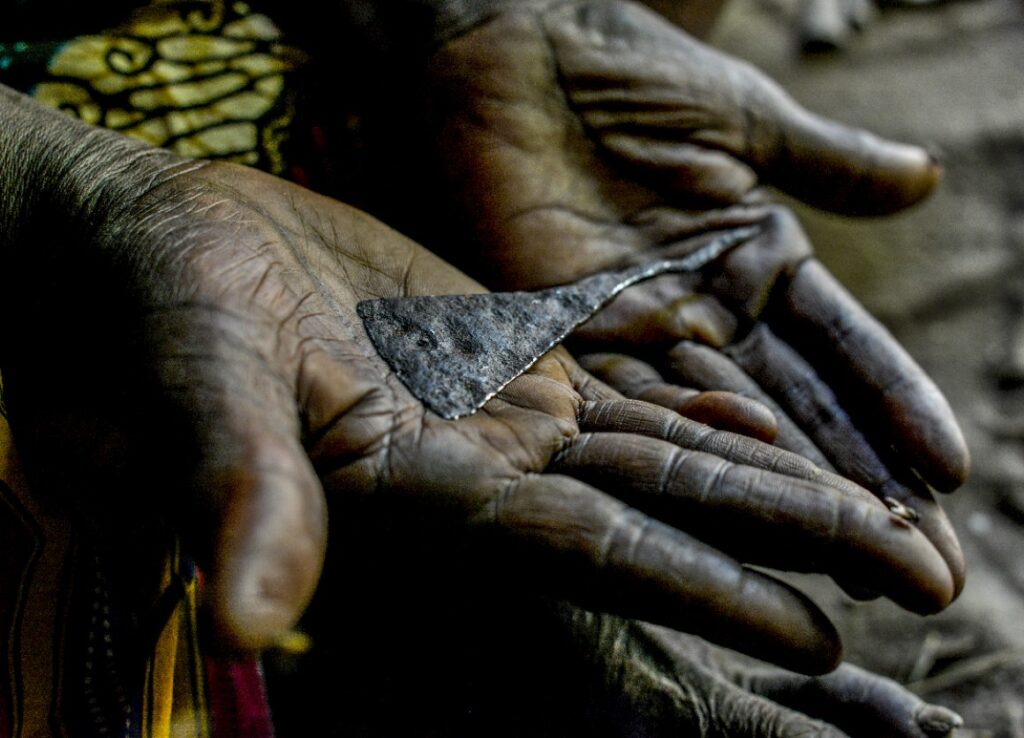 female genetal mutilations